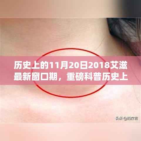 揭秘历史中的特殊日子,2018年艾滋窗口期重磅科普解读,你了解吗?